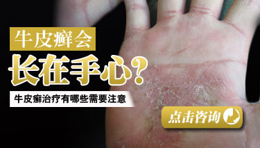 ��Щԭ��ʹţƤѢ���ε�