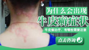 ��Ϊʲô�᳤ţƤѢ