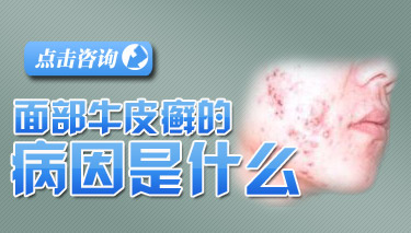 ������������ţƤѢ��ԭ��