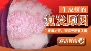 ����ţƤѢΪ�λ����