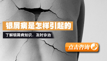 ţƤѢ������ʲô��Ⱦ