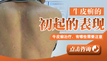 ʲô֢״��ţƤѢ