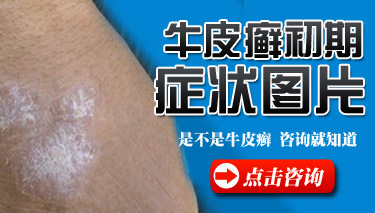 ţƤѢ��ʲô֢״ͼƬ