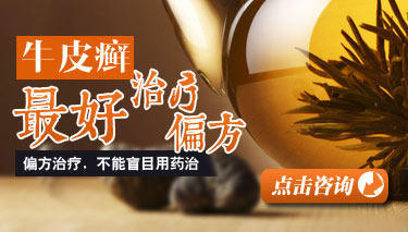 ����ţƤѢ���ط���ʲô