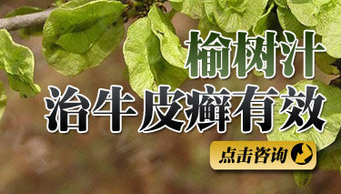 ����ţƤѢСƫ��