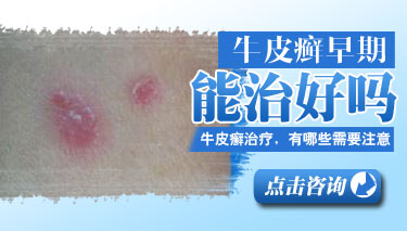 ţƤѢ�������ƺ�