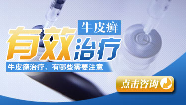 牛皮癣到底好不好治的讲 牛皮癣到底好不好治的讲