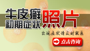 <a href=http://huashan.10yan.com/npx/npxzz/ target=_blank class=infotextkey>ţƤѢ����֢״</a>��ʲô