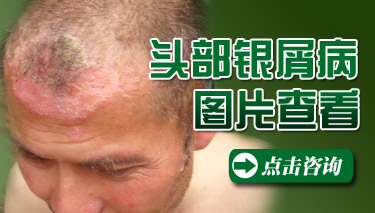 ͷ�ϳ���м��ͼƬ